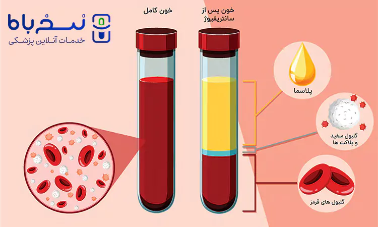 پلاسمای خون