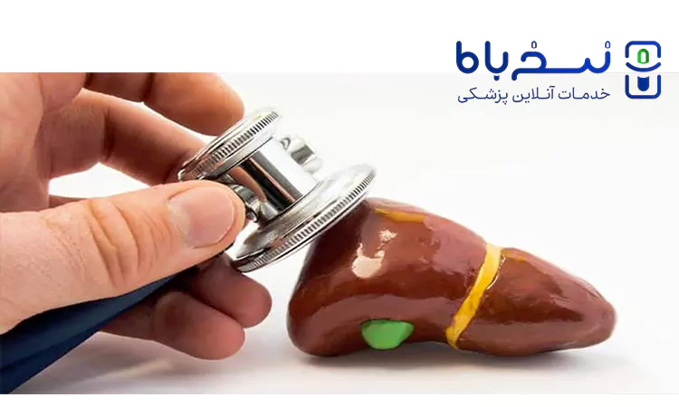 درمان سنگ صفرا