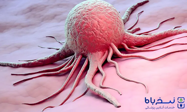 بیماریسرطان